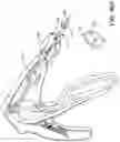 Fig. 70 - Prosthetic suturing device and methods thereof