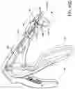 Fig. 74 - Prosthetic suturing device and methods thereof