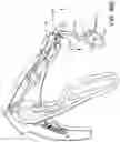 Fig. 76 - Prosthetic suturing device and methods thereof