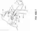 Fig. 77 - Prosthetic suturing device and methods thereof