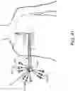 Fig. 80 - Prosthetic suturing device and methods thereof