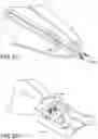 Fig. 85 - Prosthetic suturing device and methods thereof