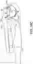 Fig. 93 - Prosthetic suturing device and methods thereof