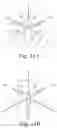 Fig. 07 - Length of self-retaining suture and method and device for using the same