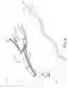 Fig. 10 - Jaw opening feature for surgical stapler