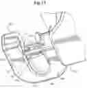 Fig. 08 - Mechanical method and apparatus for bilateral tissue fastening