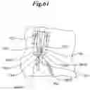 Fig. 45 - Mechanical method and apparatus for bilateral tissue fastening