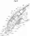 Fig. 49 - Mechanical method and apparatus for bilateral tissue fastening