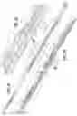 Fig. 21 - Endoscopic surgical clip applier