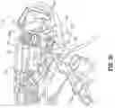 Fig. 60 - Endoscopic surgical clip applier