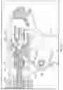 Fig. 72 - Endoscopic surgical clip applier