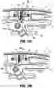 Fig. 75 - Endoscopic surgical clip applier
