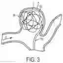 Fig. 04 - Aneurysm treatment coils and associated systems and methods of use