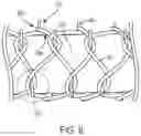 Fig. 07 - Aneurysm treatment coils and associated systems and methods of use