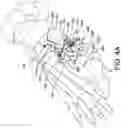 Fig. 09 - Guidance system for hallux valgus correction