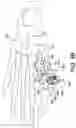 Fig. 10 - Guidance system for hallux valgus correction