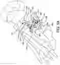 Fig. 11 - Guidance system for hallux valgus correction