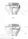 Fig. 12 - Tibial guides, tools and techniques for resecting the tibial plateau