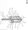 Fig. 05 - Surgical instrument