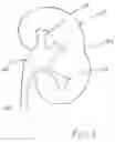 Fig. 05 - Calculus/calculi retrieving device and method