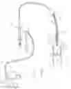 Fig. 06 - Calculus/calculi retrieving device and method