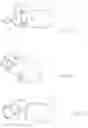 Fig. 07 - Calculus/calculi retrieving device and method