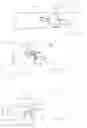 Fig. 11 - Calculus/calculi retrieving device and method