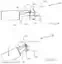 Fig. 12 - Calculus/calculi retrieving device and method