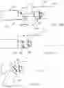 Fig. 16 - Calculus/calculi retrieving device and method