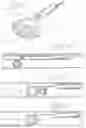 Fig. 07 - Endoscopic Stone-Extraction Device