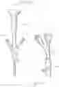 Fig. 16 - Endoscopic Stone-Extraction Device