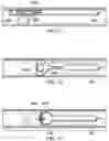 Fig. 18 - Endoscopic Stone-Extraction Device