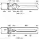 Fig. 25 - Endoscopic Stone-Extraction Device