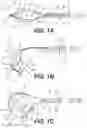 Fig. 02 - Retrieval devices and related methods of use