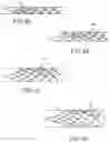 Fig. 05 - Electrically assisted attachment of medical devices to thrombus