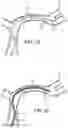 Fig. 18 - Electrically assisted attachment of medical devices to thrombus