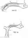 Fig. 19 - Electrically assisted attachment of medical devices to thrombus