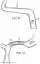 Fig. 21 - Electrically assisted attachment of medical devices to thrombus