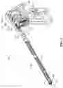 Fig. 02 - Surgical instrument and removable end effector apparatus