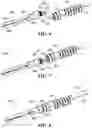 Fig. 04 - Surgical instrument and removable end effector apparatus