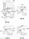 Fig. 08 - Methods and devices for puncturing tissue