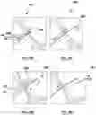 Fig. 18 - Methods and devices for puncturing tissue