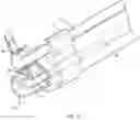 Fig. 04 - Endoscopic submucosal dissection hood