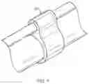 Fig. 08 - Endoscopic submucosal dissection hood