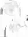 Fig. 15 - Method and system for harvesting biological tissue