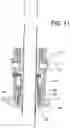 Fig. 11 - Trocar support