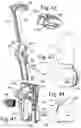 Fig. 14 - Needle guide devices for mounting on imaging transducers or adaptors on imaging transducer, imaging transducers for mounting needle guide devices and adaptors for imaging transducers for mounting needle guide devices thereon