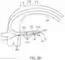 Fig. 15 - Guide extension catheter assemblies, systems and methods of use