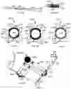 Fig. 10 - Guide device suitable for performing temporomandibular joint arthroscopy