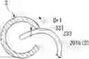 Fig. 01 - Tissue-fastening tool indwelling system and method for indwelling tissue-fastening tool